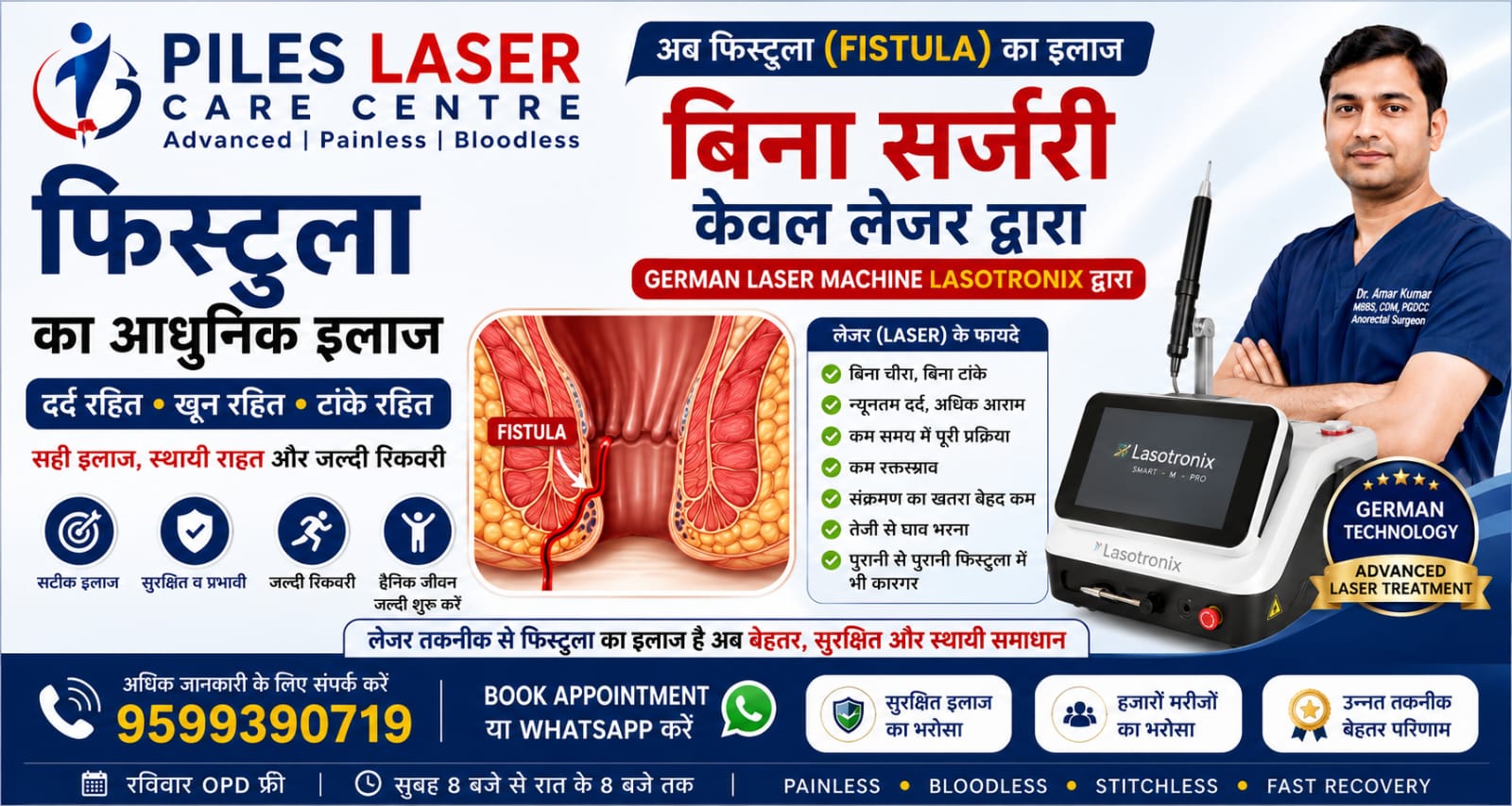 Fistula laser treatment information